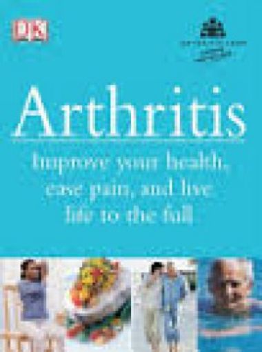 Picture of Arthritis Your Questions Answered