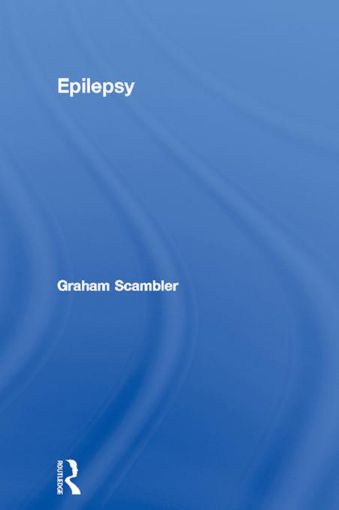 Picture of Epilepsy